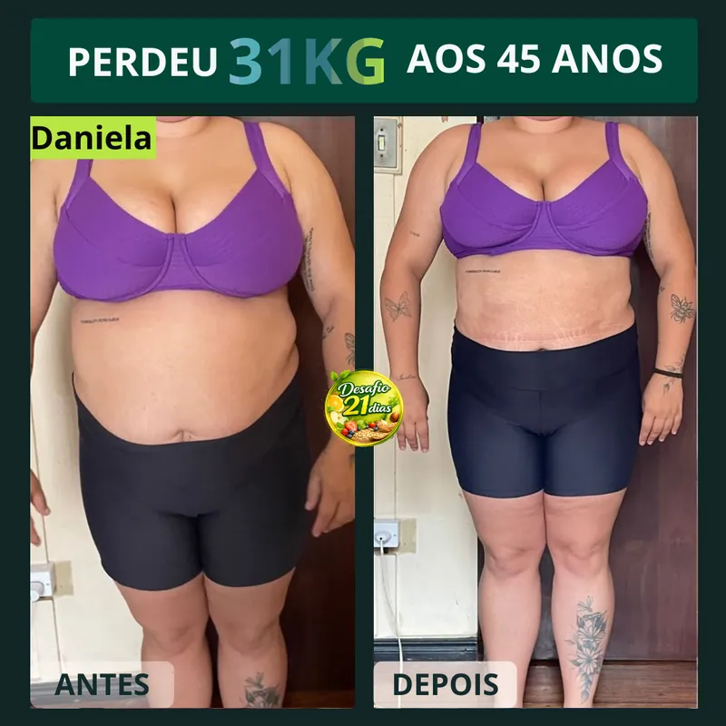 Antes e Depois 3